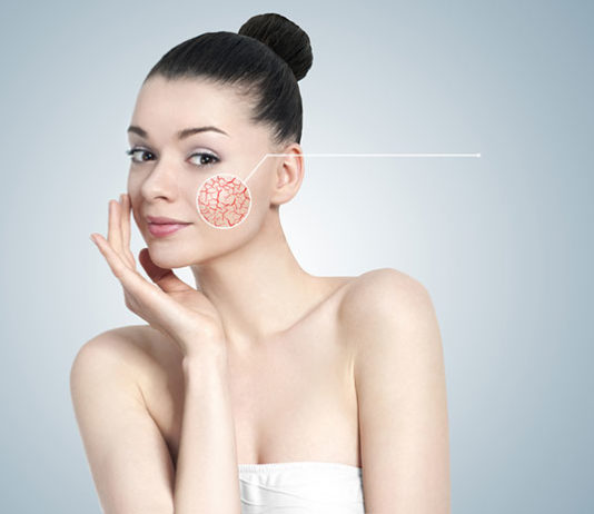 Laserowe usuwanie popękanych naczynek - pozna dwa lasery, które pomogą Ci się ich pozbyć w całości!